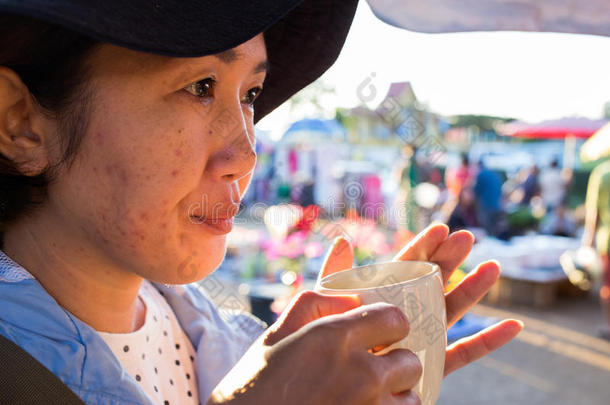 亚洲女人喝辅食饮料面部痤疮