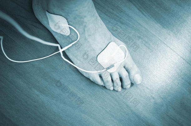 胶粘剂成人可供替代的和踝关节