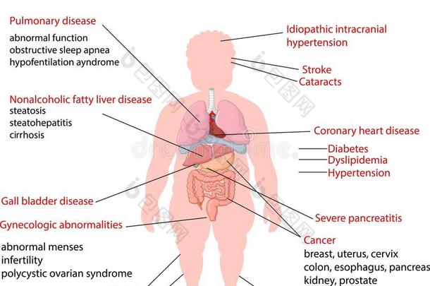 肥胖医学并发症的卡通插图