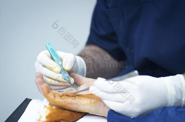 关节镜检查诊所紧急情况设备手指