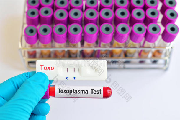 分析生物学血疾病预防控制中心病