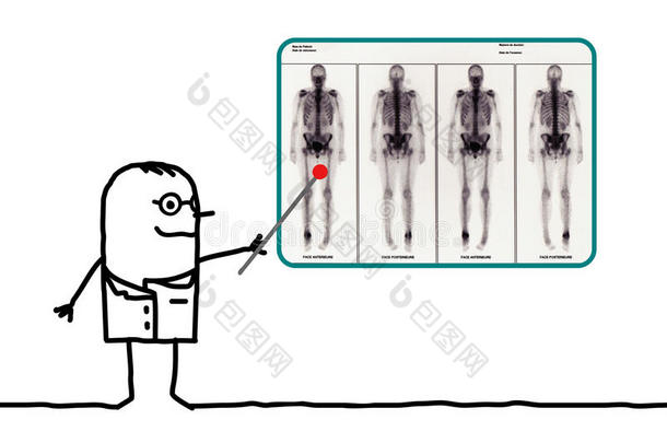 卡通人放射科医生显示闪烁的结果