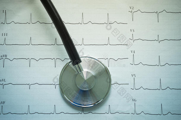 击败心电图机心脏病学家图表检查