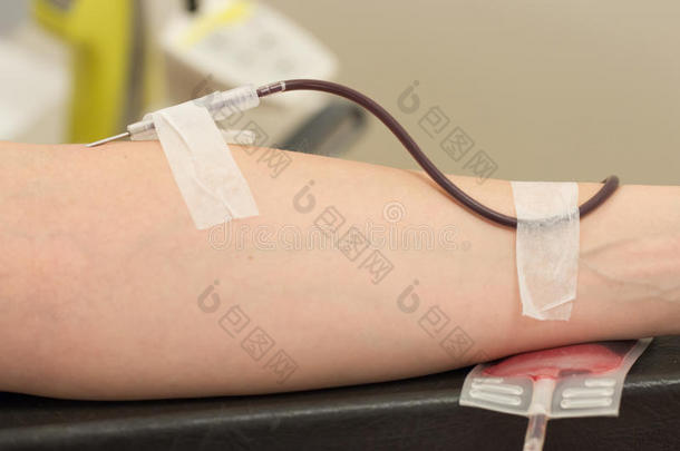 在扶手椅上的捐献者血液，特写