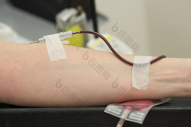 在扶手椅上的捐献者血液，特写