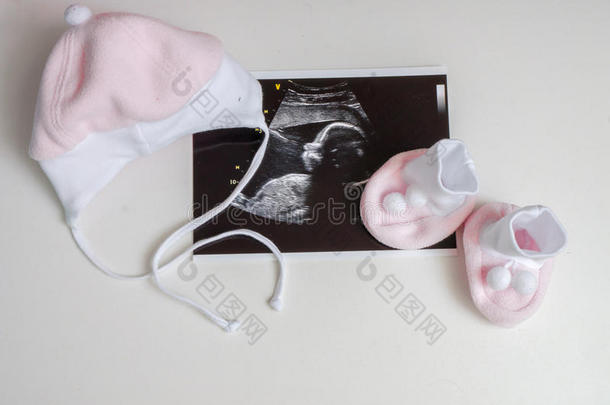 婴儿衣服和超声波图片。 怀孕概念中的期待
