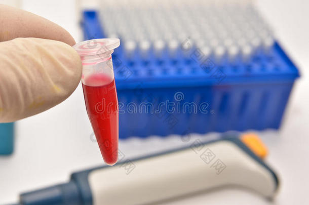 临床诊断实验室的血液测试。