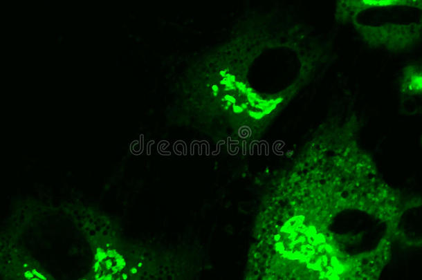 间充质干细胞