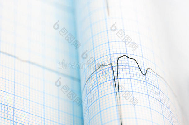 心电图曲线折叠在纸上