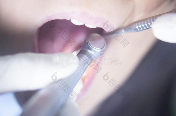 牙科病人口腔牙科检查