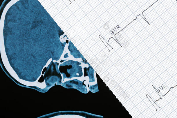 ct扫描和心电图片段