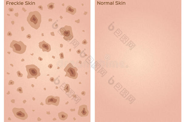 雀斑皮肤纹理图形