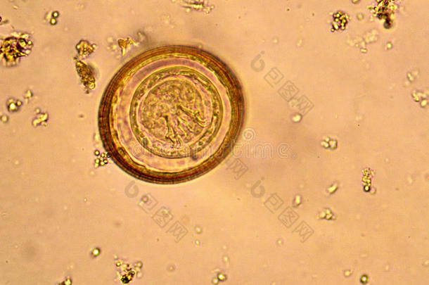 棘头分析钩虫瘤蛔虫病蛔虫