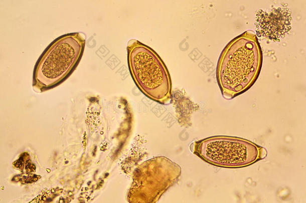 棘头分析钩虫瘤蛔虫病蛔虫