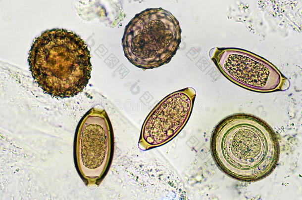 棘头分析钩虫瘤蛔虫病蛔虫