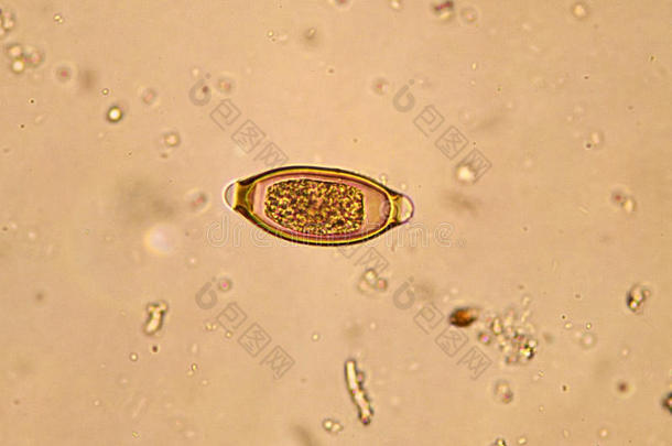 棘头分析钩虫瘤蛔虫病蛔虫