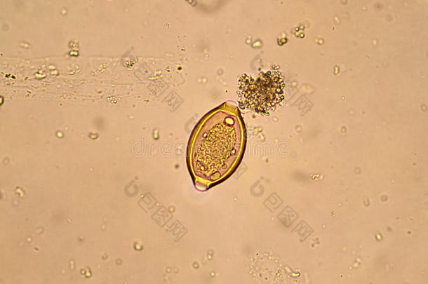 棘头分析钩虫瘤蛔虫病蛔虫