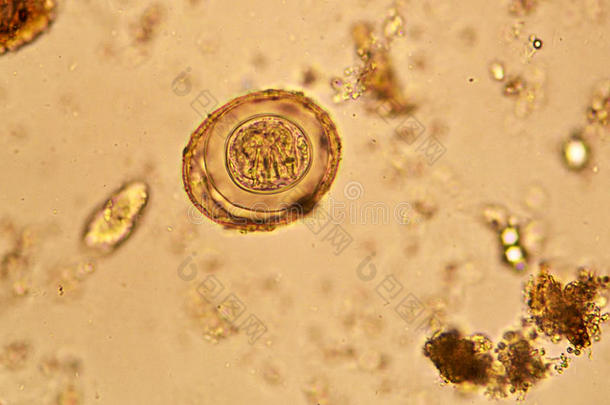 棘头分析钩虫瘤蛔虫病蛔虫