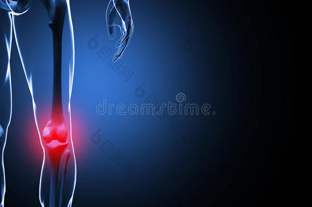 三维插图膝关节疼痛骨骼