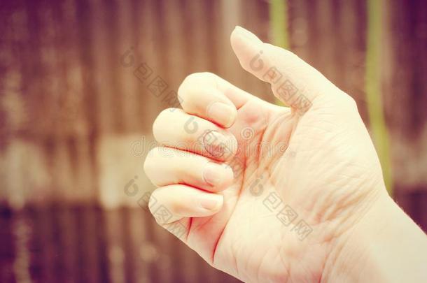 手指甲真菌病。 脚趾甲真菌。-软焦点