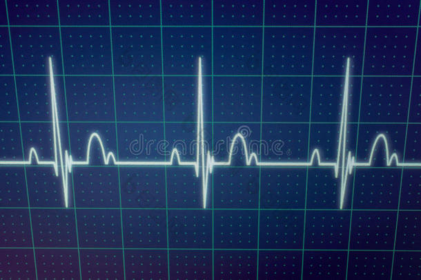 心电图/EKG监视器