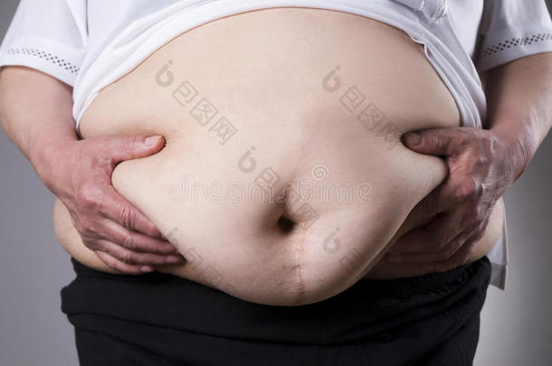 腹部脂肪肥胖解剖身体