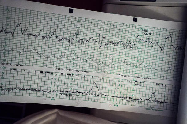 实践中的CTG扫描