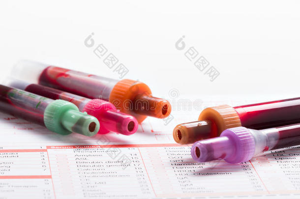 血液测试，实验室表格上的血液样本