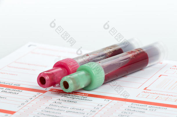 血液测试，实验室表格上的血液样本