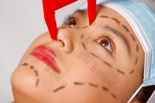 特写年轻妇女的脸准备整容手术与线绘制在皮肤上，医生测量使用红色工具，作为