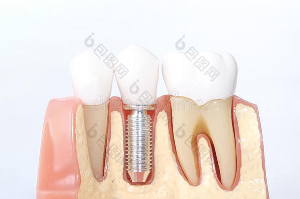 通用<strong>牙齿</strong>模型