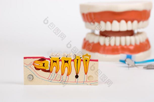 牙齿模型和牙科工具