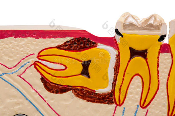 牙科模型，牙齿模型