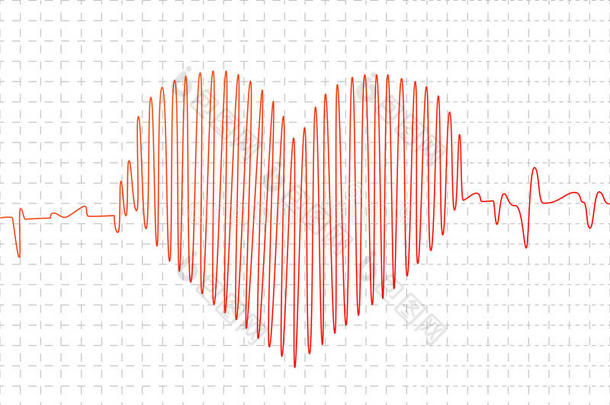 分析击败心脏的心电图心电图机