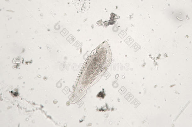 淡水浮游动物可能是原生动物纤毛纤毛虫