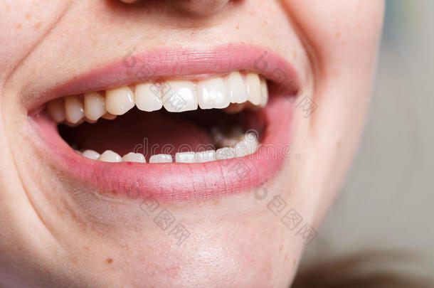 牙科、牙科、口腔和牙齿微笑