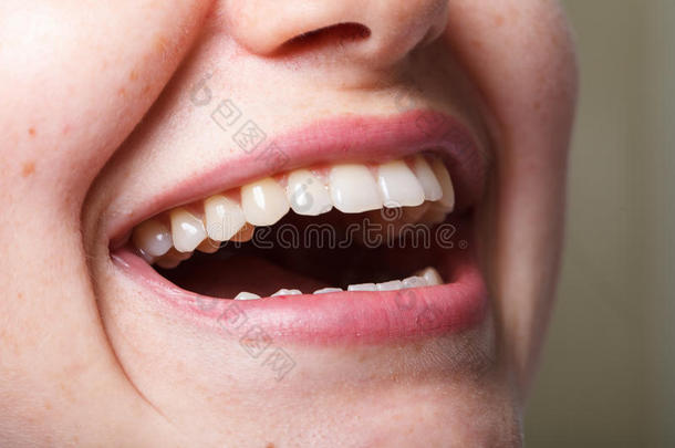 牙科、牙科、口腔和牙齿微笑