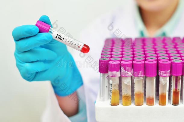 伊蚊分析血照顾疾病预防控制中心