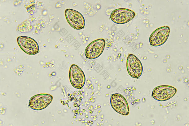 棘头分析钩虫瘤蛔虫病蛔虫