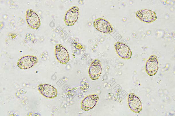 棘头分析钩虫瘤蛔虫病蛔虫