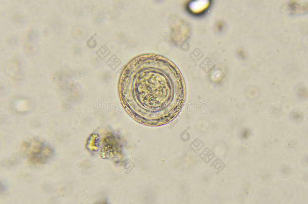 棘头分析钩虫瘤蛔虫病蛔虫