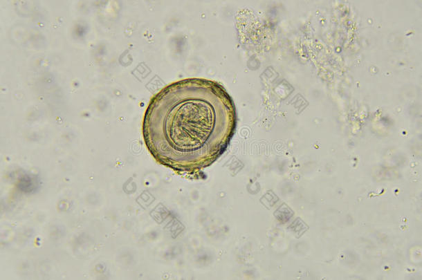 棘头分析钩虫瘤蛔虫病蛔虫