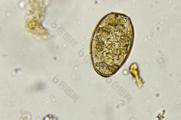 棘头分析钩虫瘤蛔虫病蛔虫