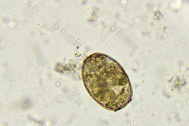 棘头分析钩虫瘤蛔虫病蛔虫