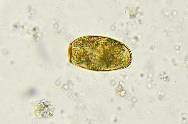 棘头分析钩虫瘤蛔虫病蛔虫