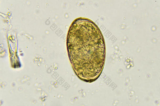 棘头分析钩虫瘤蛔虫病蛔虫