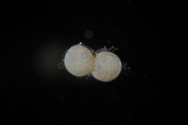 淡水腹足类蜗牛的卵经显微镜观察。 不需要的或有用的水族馆居民