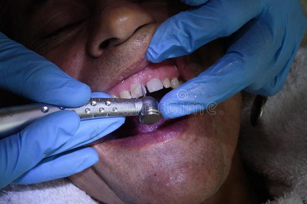 牙科医生医学的医学操作