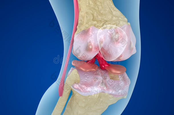 疼痛解剖学的解剖学解剖关节炎