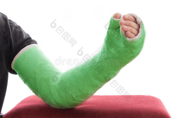绿色长臂石膏/玻璃纤维铸造休息在脚凳上